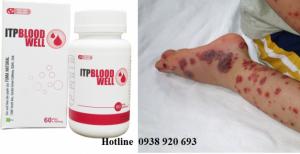 ITP Bloodwell hỗ trợ điều trị giảm tiểu cầu...